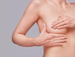 Brustverkleinerung und Bruststraffung