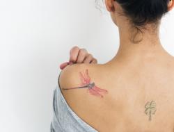 Laser Tattooentfernung: Kosten, Nebenwirkungen & Ablauf