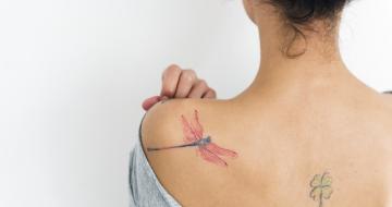 Laser Tattooentfernung: Kosten, Nebenwirkungen & Ablauf